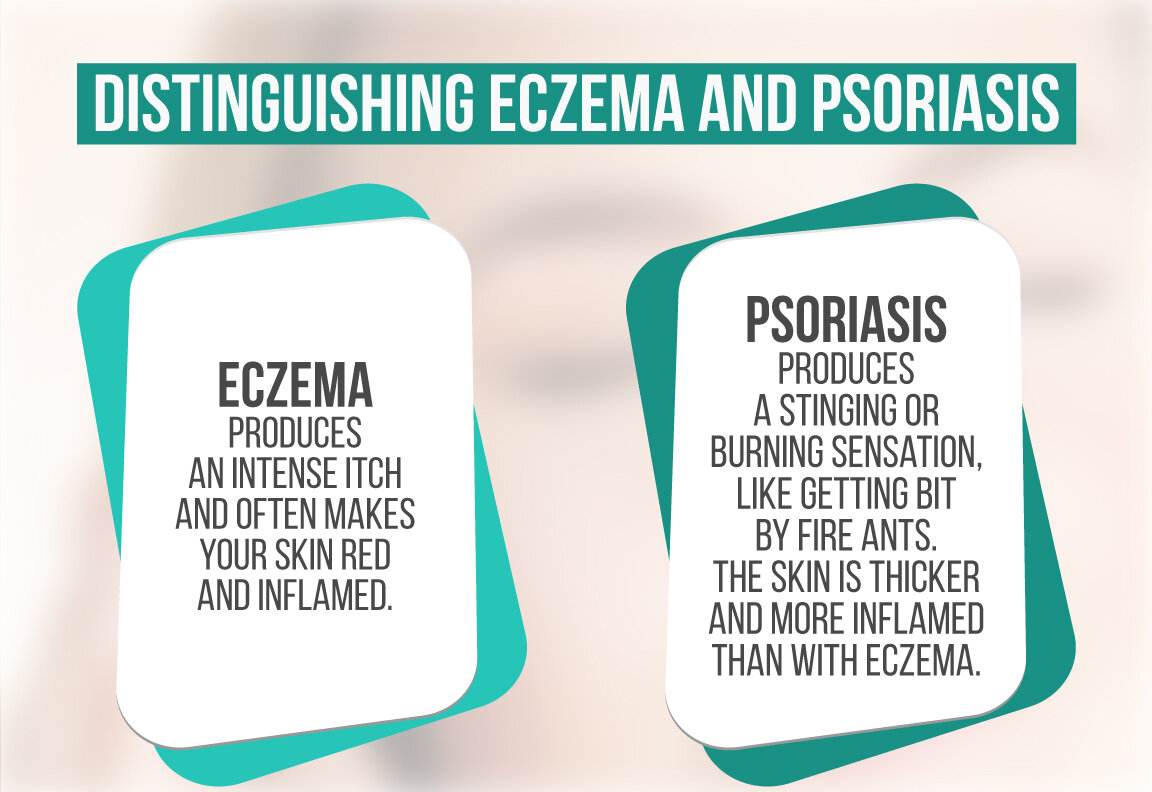 distinguishing eczema from psoriasis.jpg