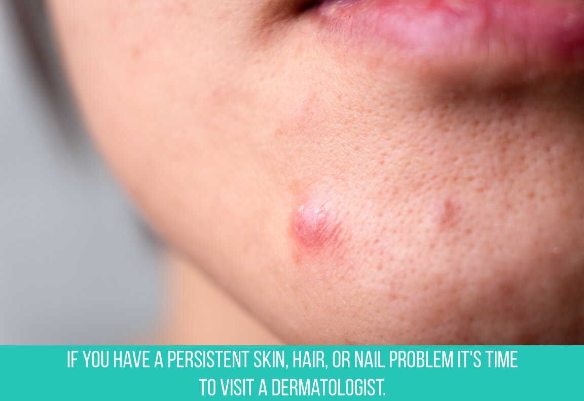 visit a dermatologist for a skin hair or nail problem.jpg