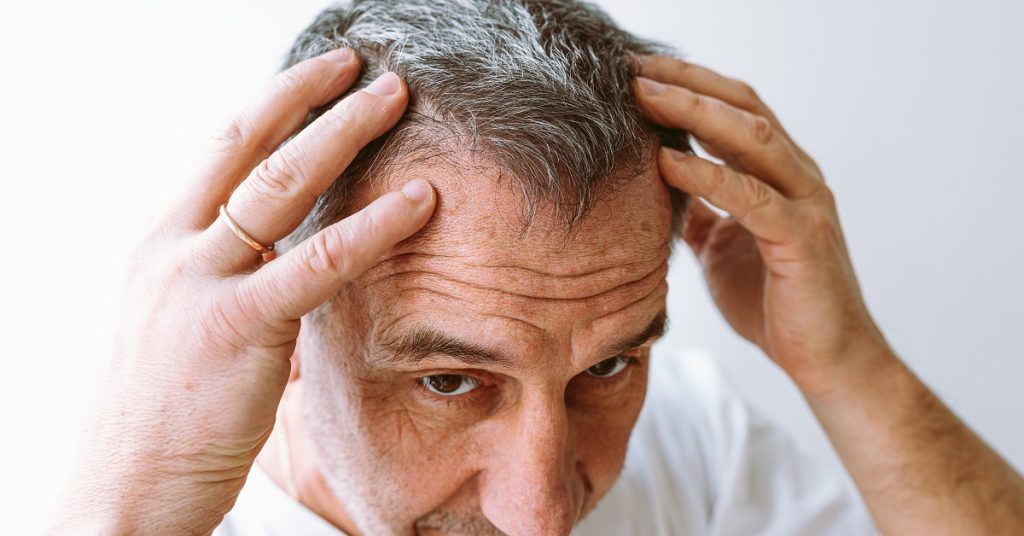 Understanding PRP for Hair Loss