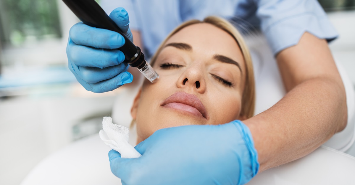 What is Microneedling and Why is it So Popular?
