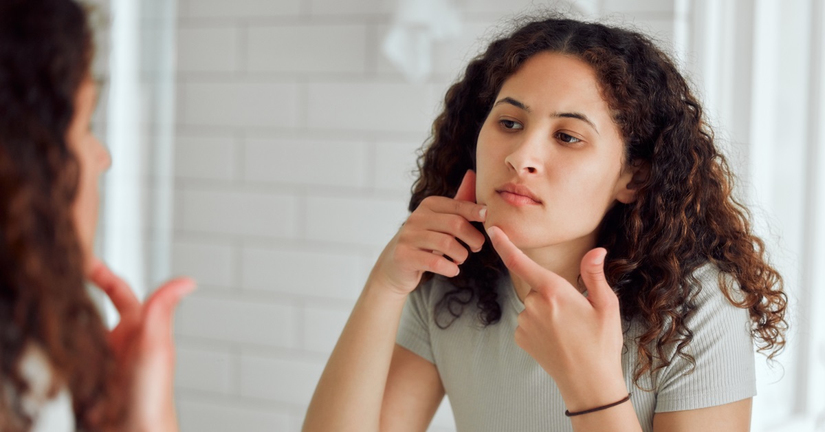 Understanding the Different Types of Acne Scars and How to Treat Them